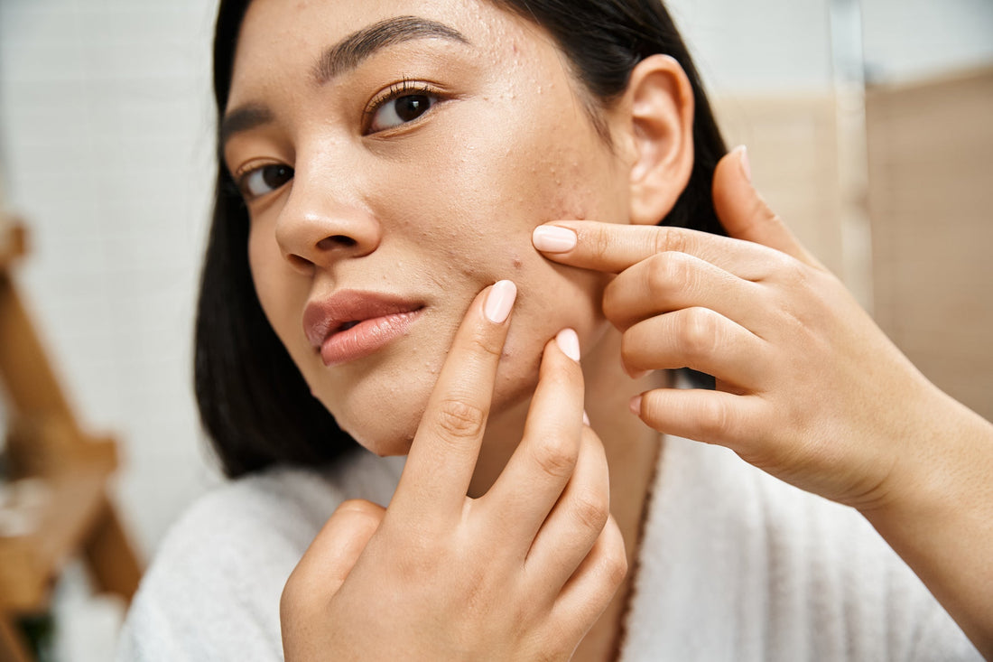 Peau à tendance acnéique et sensible : comment calmer, purifier et cicatriser sans agresser ?