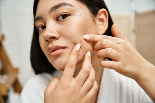 Peau à tendance acnéique et sensible : comment calmer, purifier et cicatriser sans agresser ?