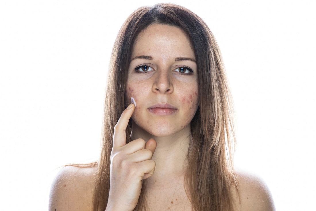 Rougeurs, irritations, micro-lésions : comment aider la peau à se réparer rapidement ?